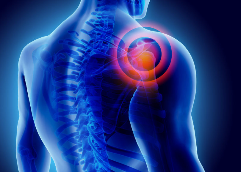 Shoulder pain treatment in forest hills ny