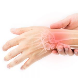 Cubital Tunnel Syndrome treatment in forest hills ny