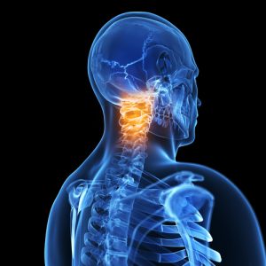 Whiplash Injury Treatment - No Fault Doctor in Forest Hills, Queens, NY